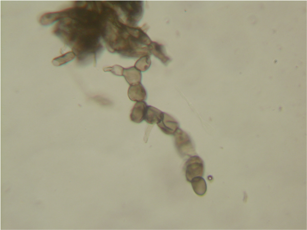  Spores на гъбички под микроскоп